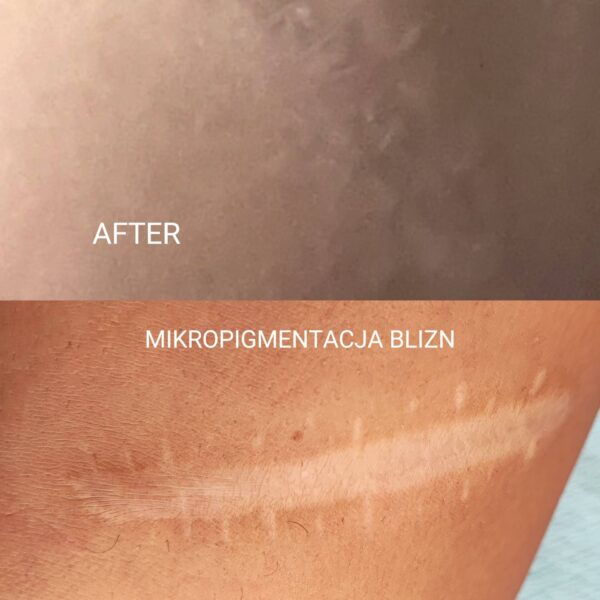 BLIZNA-ok-08.2024-scaled-1