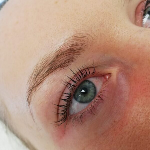 Lifting-rzes-Klient-po-768x1024-1