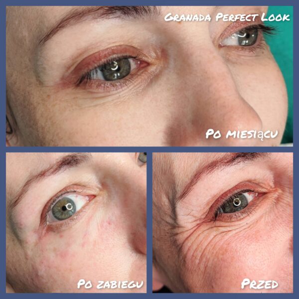 Mezo-oczy-05.23-2-z-logo-scaled-1