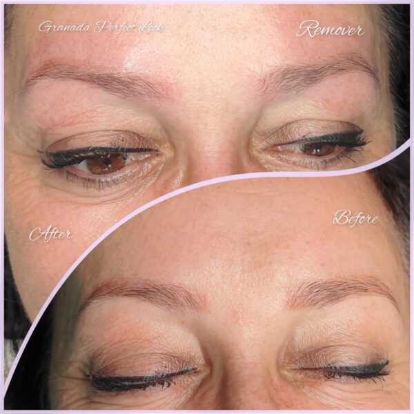 Remover-brwi-1-zabieg-scaled-1