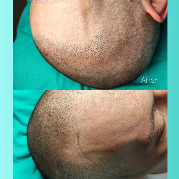 Robert-pigment-glowa-1-scaled-1